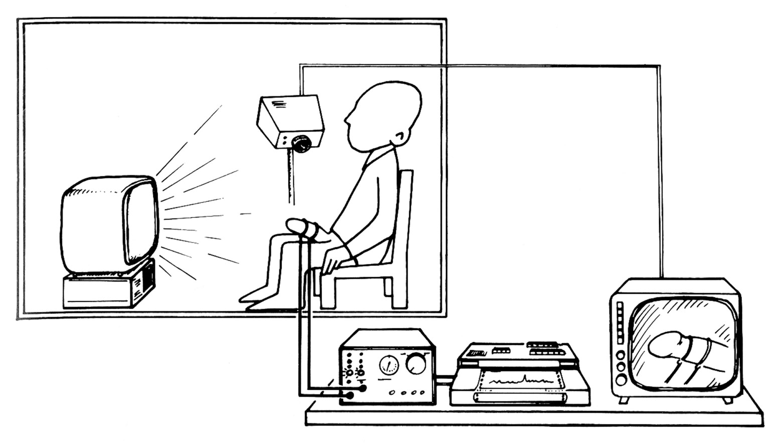 A 1990 drawing showing a subject of impotence testing. The drawing is from the article “Visual Sexual Stimulation Plethysmography: Complementary Test to Nocturnal Penile Plethysmography,” in “Urology” volume thirty-five, number six. 