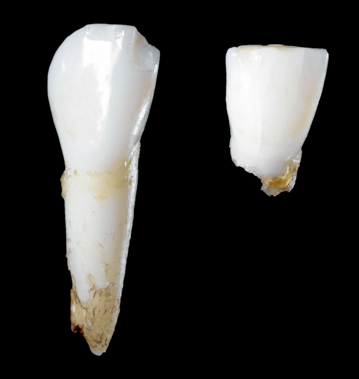 A photograph of milk teeth with and without their roots. 