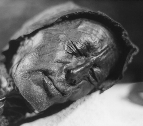 A photograph of the Tollund Man, peacefully at rest at Silkeborg Museum, Denmark.