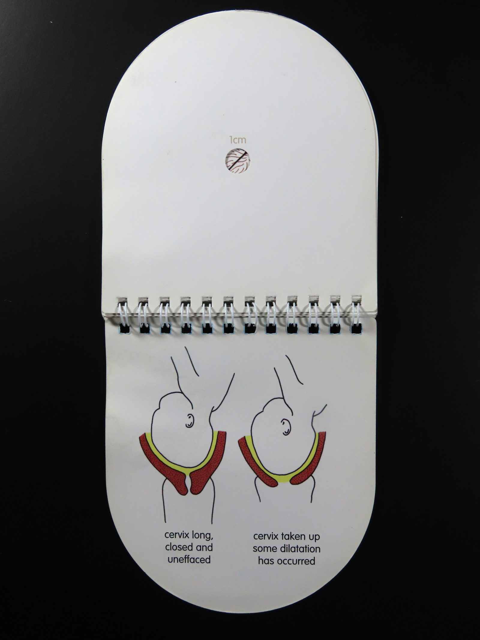 Two interior pages from Jean Aspin’s “Vaginal Examination: A Unique Pocket Guide”