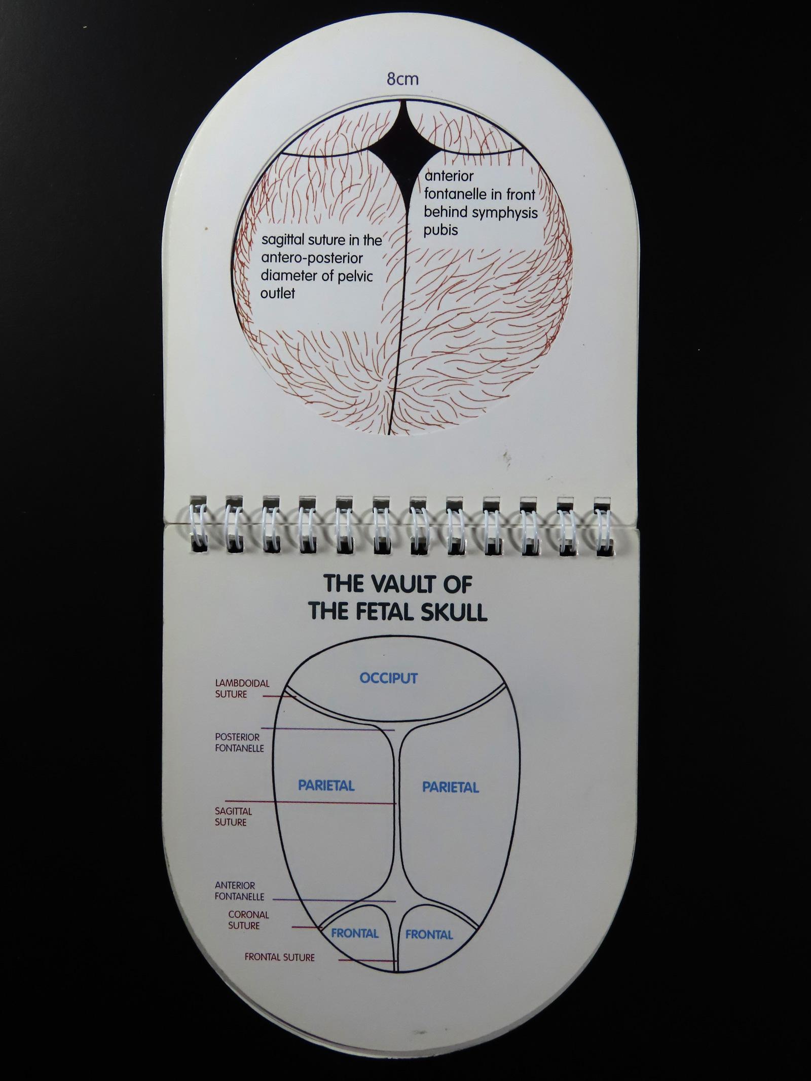 Two interior pages from Jean Aspin’s “Vaginal Examination: A Unique Pocket Guide”