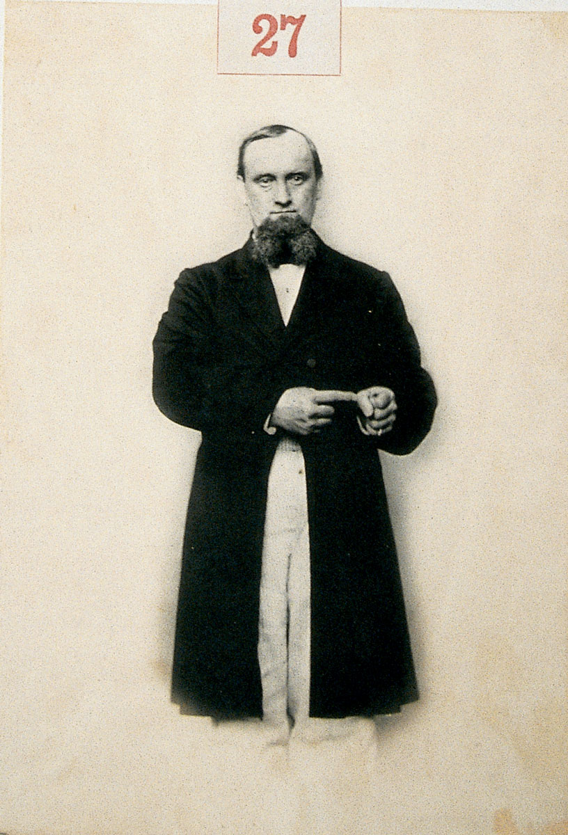 Photograph of a man pointing at his hand.