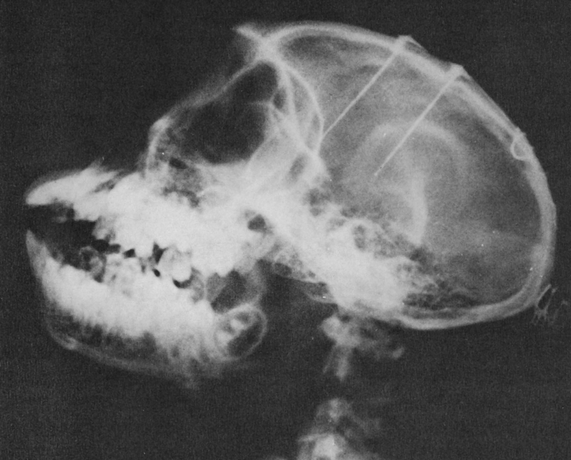 X-ray of a monkey’s head showing two assemblies of electrodes implanted in the frontal lobes and in the thalamus. Photo taken from Delgado’s book Physical Control of the Mind.