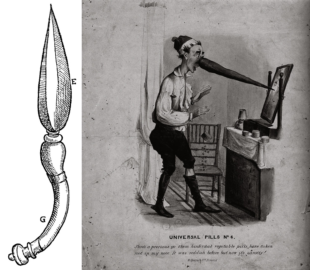Two images. A drawing of a knife in the form of a myrtle leaf for shaping the nostrils. From Gasparo Tagliacozzi's fifteen ninety seven 