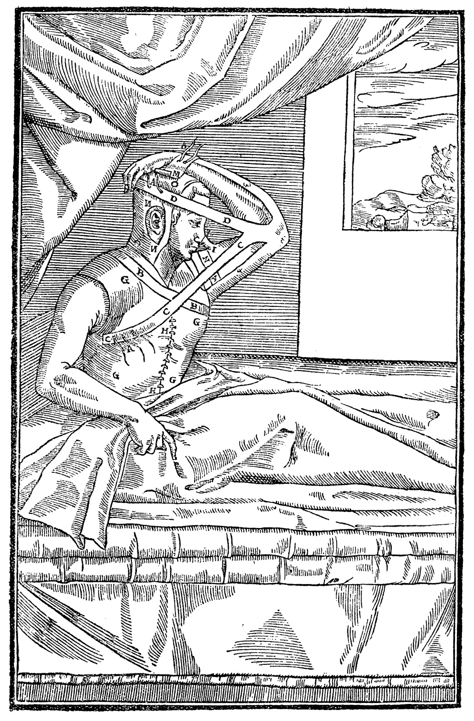 An illustration depicting an early Venetian rhinoplasty. 