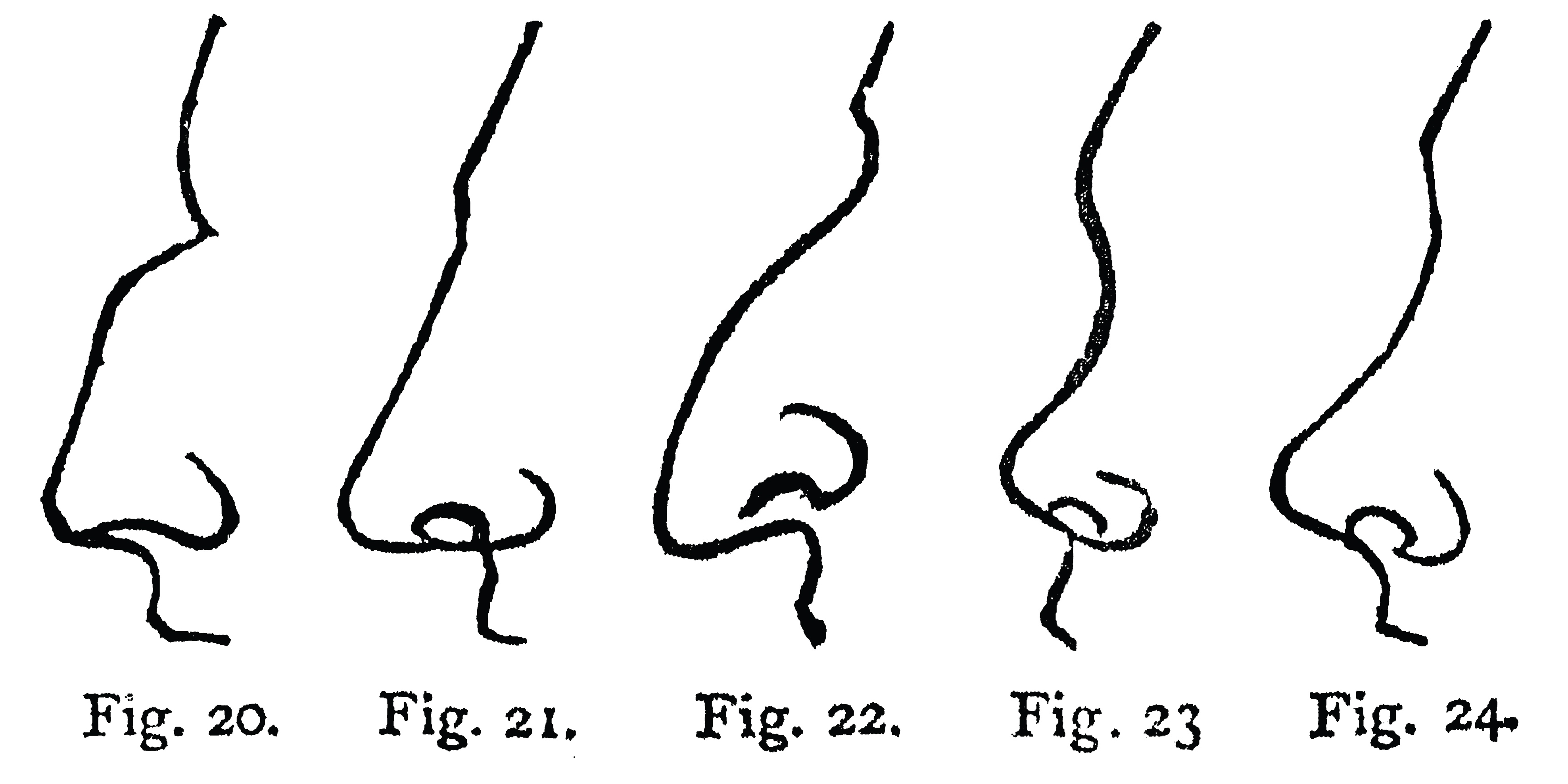 A diagram of five different nose 