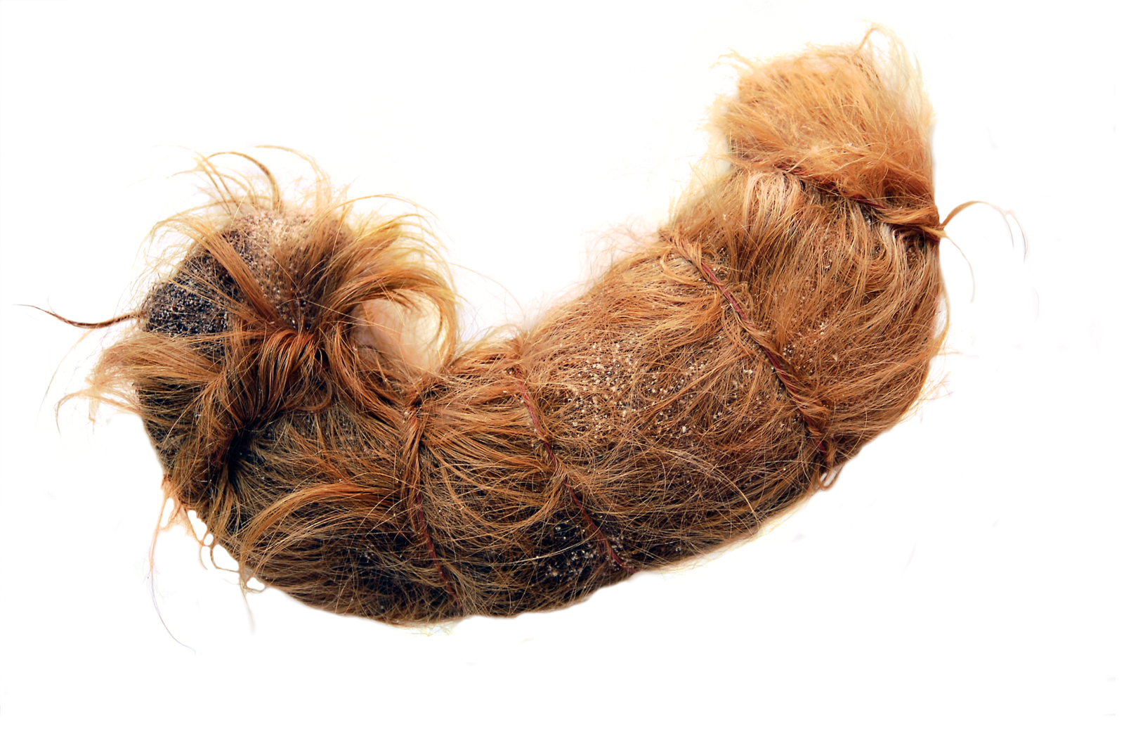 A photograph of a hairball removed during surgery from the stomach of a twelve-year-old girl in nineteen sixty four. From age six she had suffered from trichophagia, an emotional disorder causing a person—most often a girl entering puberty—to eat their hair