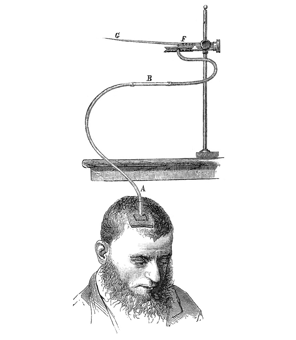 An illustration of an apparatus used for measuring the pulse of the brain, from 