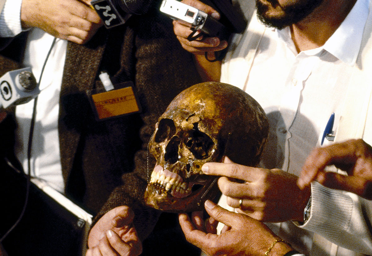 A nineteen eighty-five photograph of the skull of Josef Mengele on display for reporters and news crews in Embu, Brazil. The Auschwitz doctor’s bones were unearthed in a small cemetery there in a grave marked “Wolfgang Gerhard.”