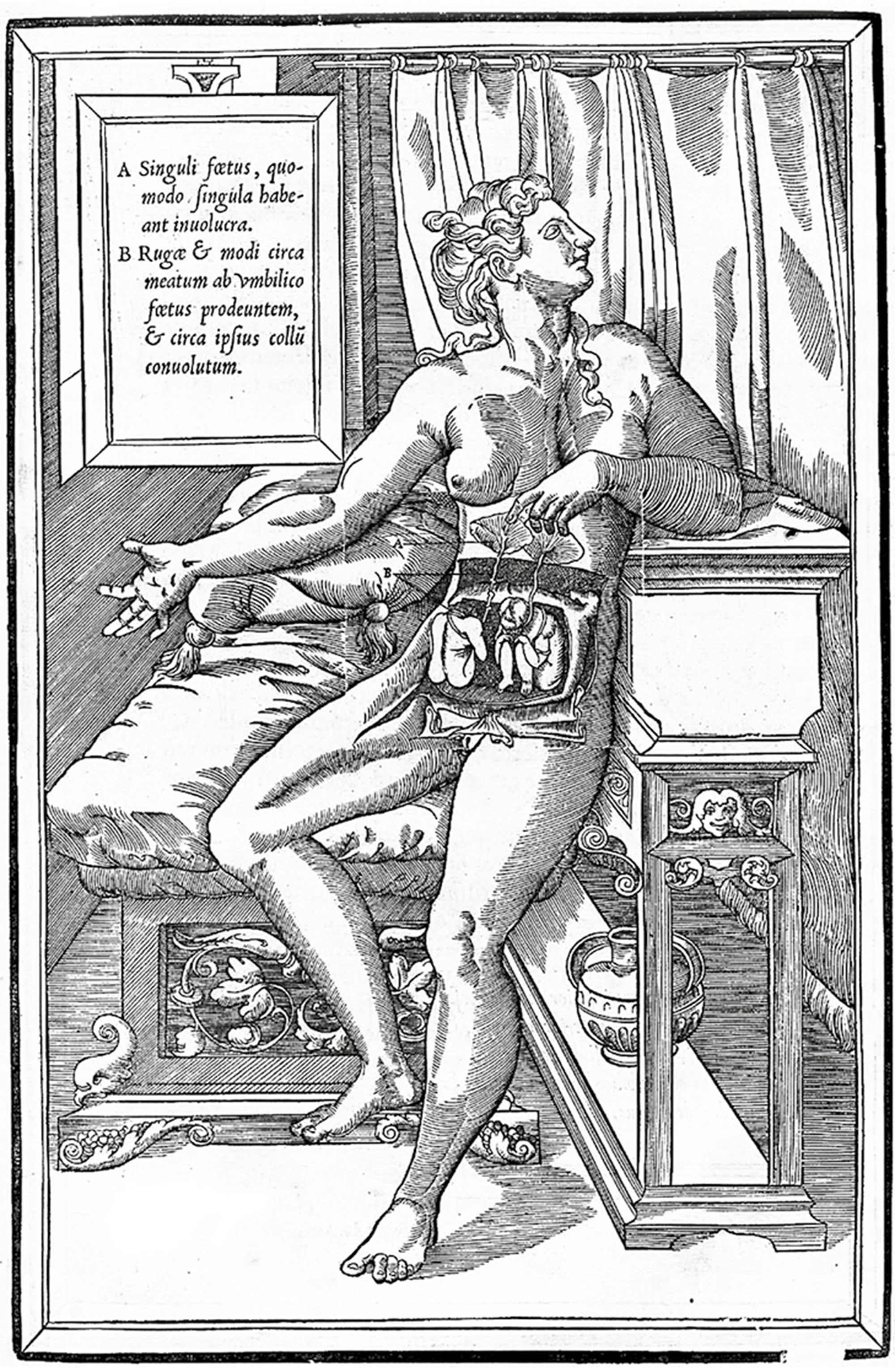 An illustration from Charles Estienne’s fifteen forty-five “De dissectione” showing twins in the womb.