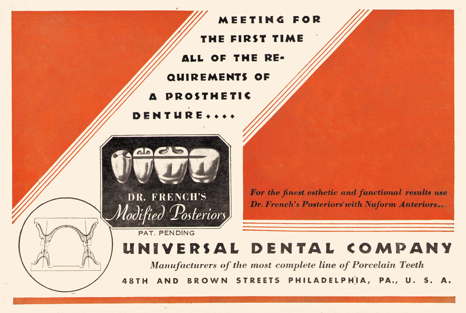 A photograph of the orange-and-cream-colored box lid for Felix A. French’s Modified Posteriors. French, who believed that anatomically formed dentures were not meeting expectations, had spent eight years developing his design, which came in both porcelain and acrylic varieties. 