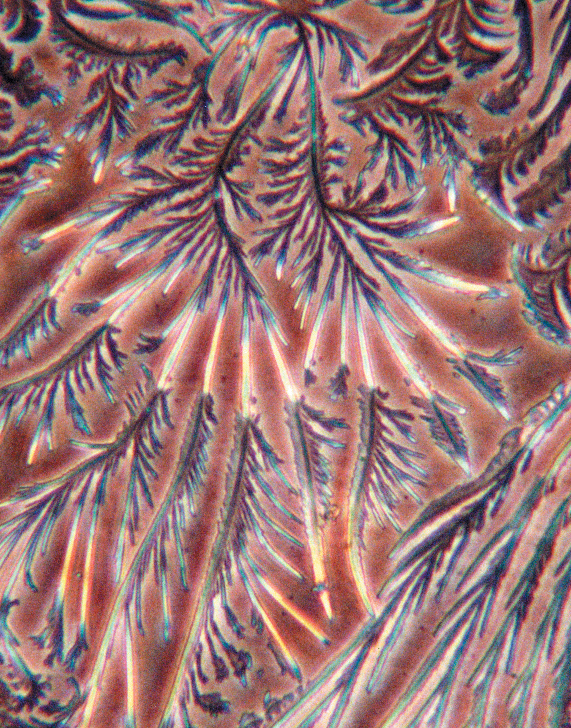 Microphotograph of prothrombin dried on a glass slide. The fern-like fractal structure of this bio-polymer responsible for blood clotting demonstrates its liquid crystalinity.